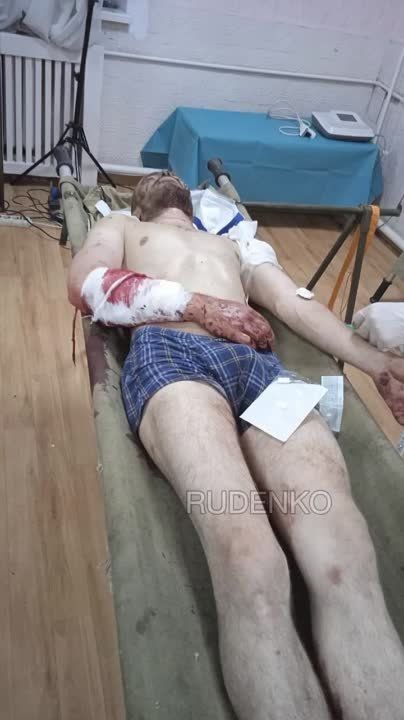 Андрей Руденко: Пленные военнослужащие ВСУ, которые чудом остались в живых после "удачного контрнаступа"