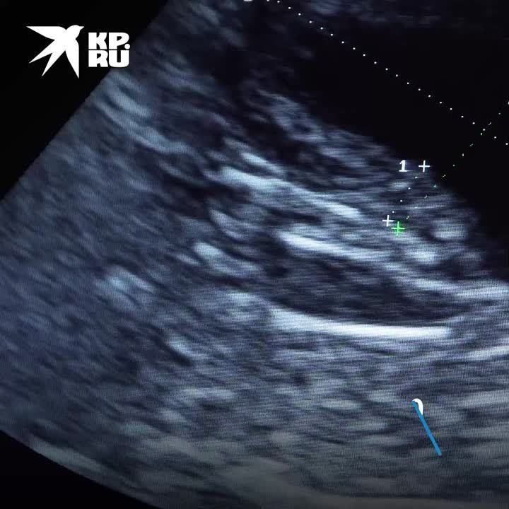 � ���������� ������ ���������� � ����� ���������� ���������� �����
