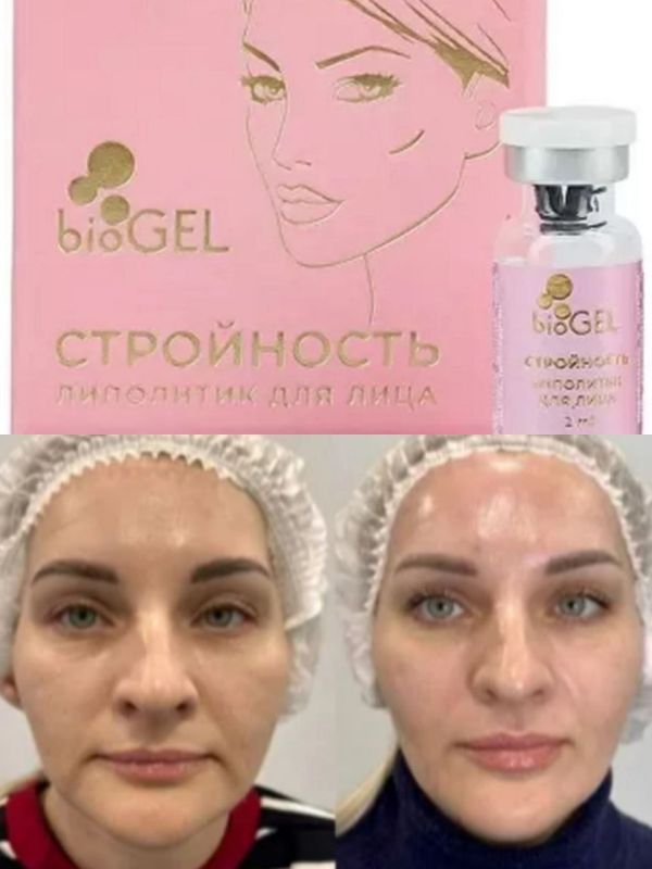 ��������� ��������� ��� ����