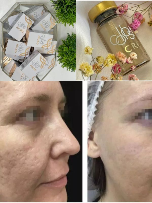 MICRO COLLOST. ��������� � ��������� ������� � ��� ��������, ������� ����������� ��������� �� ������ ������� � ���������...
