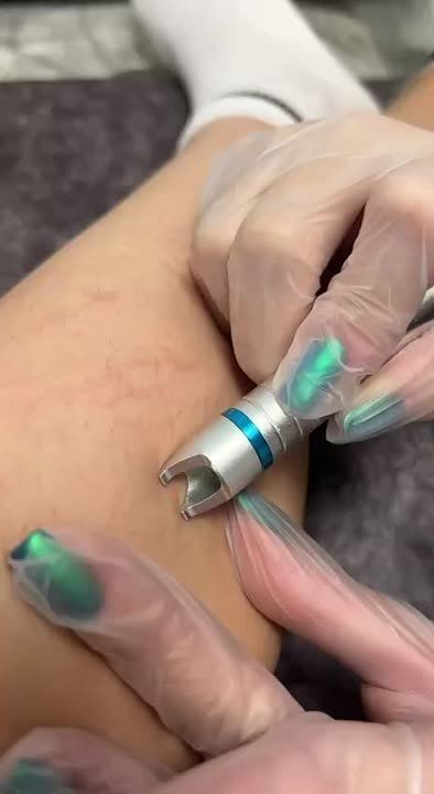 ���������� � ��� ���������� ��: