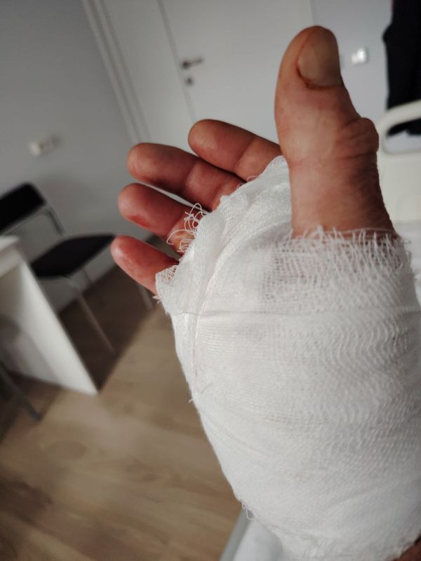 Максим Пухов: Спасибо врачам МСЧ-145 г. Энергодар, вы - настоящие профессионалы, прооперировали мою правую кисть