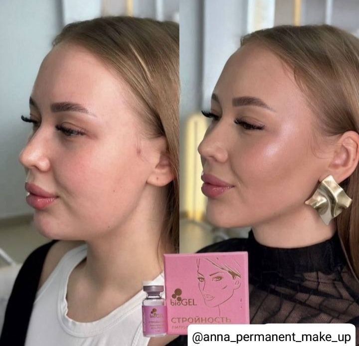 ПЕПТИДНЫЙ ЛИПОЛИТИК ДЛЯ ЛИЦА