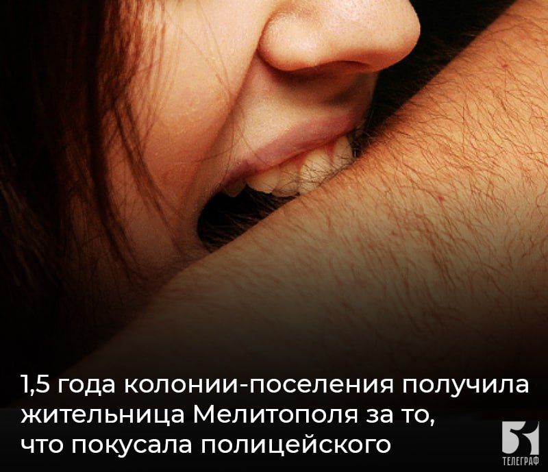 1,5 года колонии-поселения получила жительница Мелитополя за то, что покусала полицейского