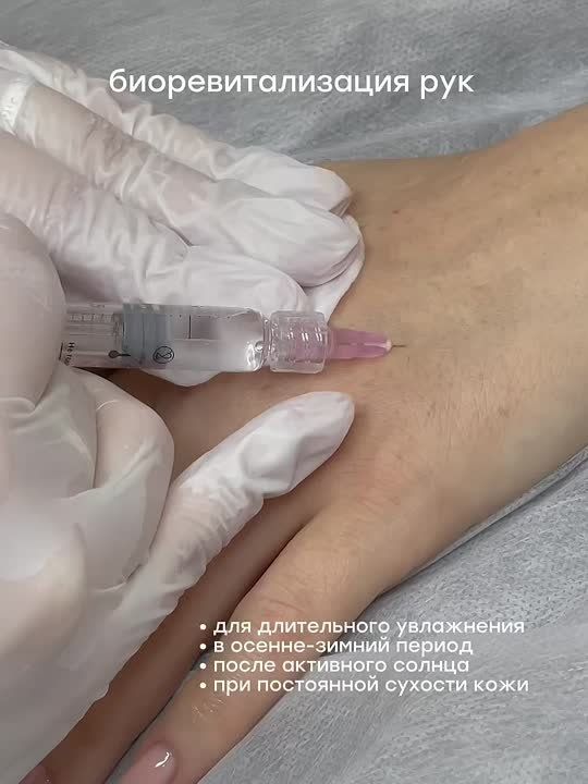 Ваши руки нуждаются в увлажнении!
