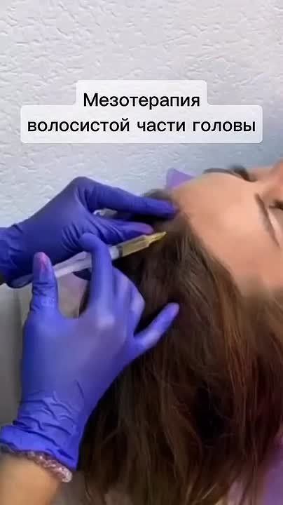 Мезотерапия волос летом — спасение от агрессивного солнца и не только!