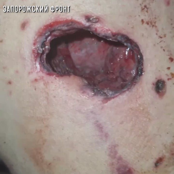 На Запорожском направлении