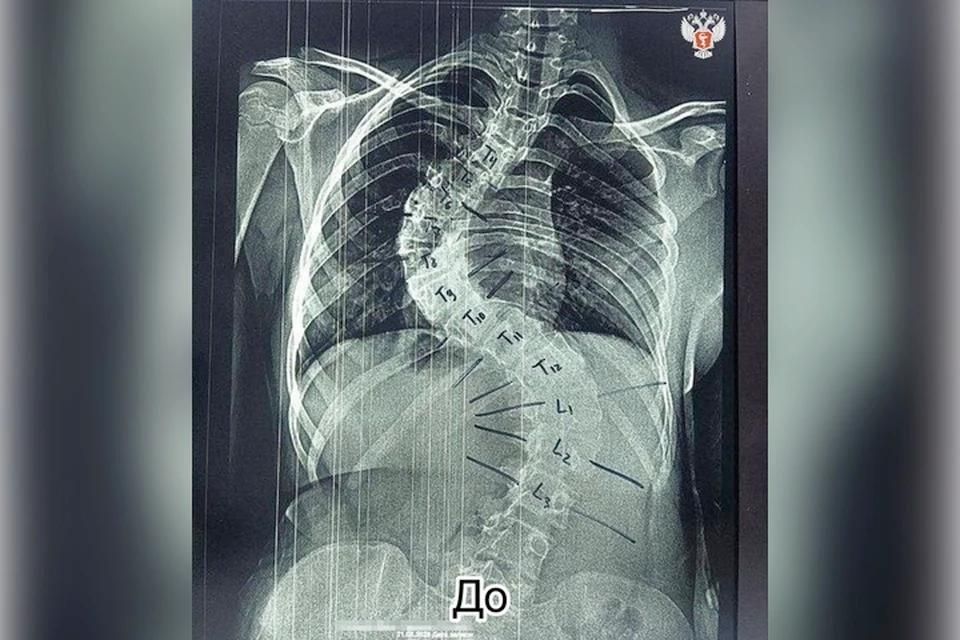 �� ����� ��� ������, � ������ ������� ������: 13-������ ������� ������ �����