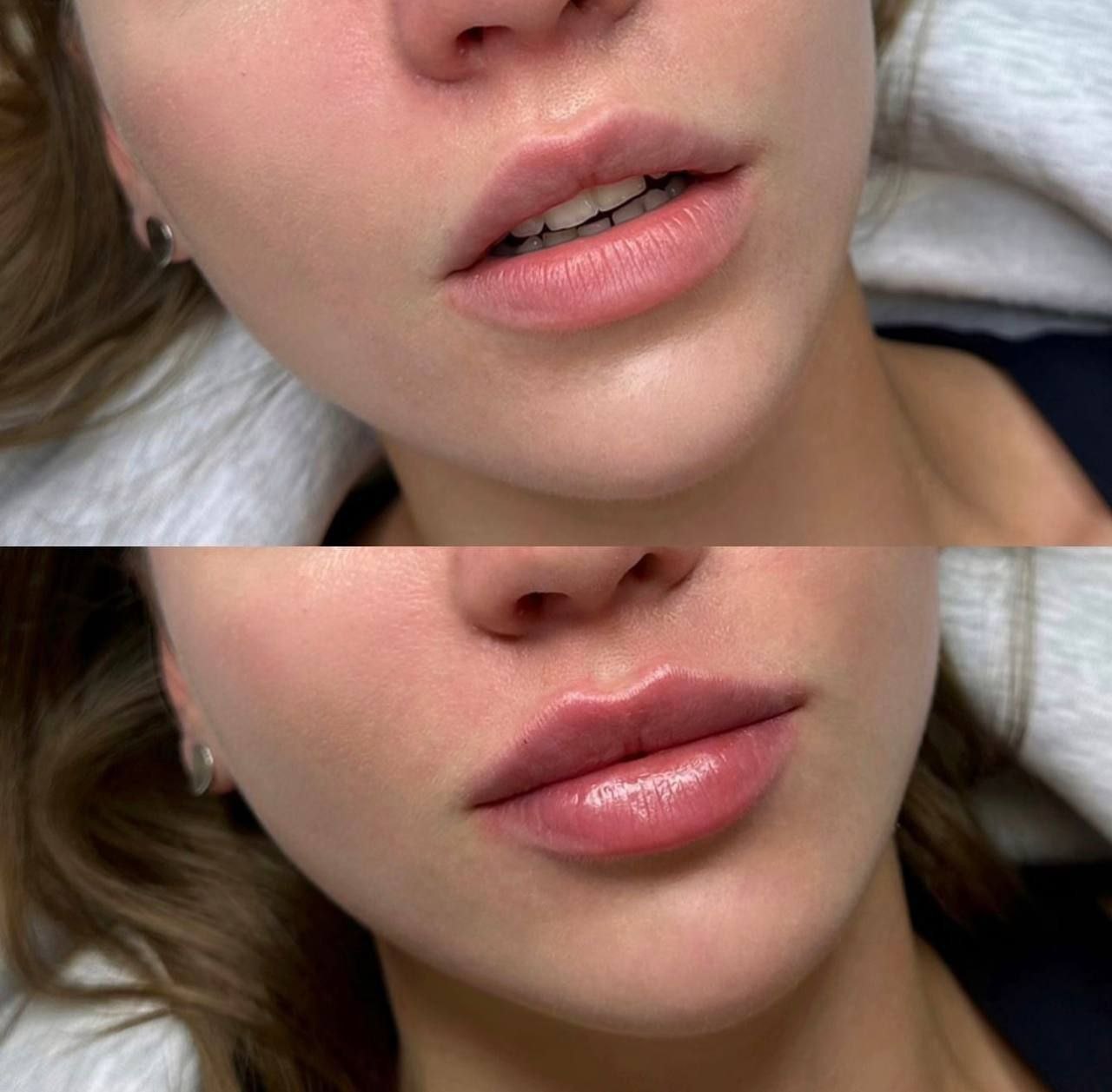 311111164. Идеальный. объем и манящие формы