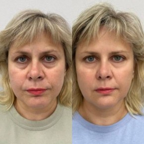 RF-  !.                ,  ,  