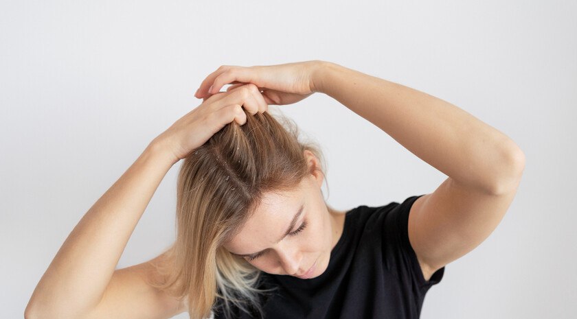 Сыпучая шевелюра. Трихолог объяснила, почему нет универсального средства от перхоти