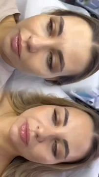 311111164. 11 Приём ведёт команда специалистов с медицинским образованием в области косметологии прием будет проводиться 11 февраля