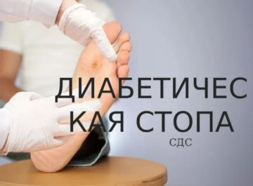 �������� ������ � �������� ������ �����������: ������������ �� �����