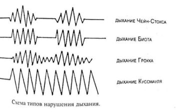 ������������ ��������� �������;