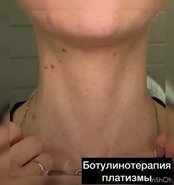 311111165. �������� ������������� ��������� ������� ���������� �������� � ��������� � ������������ ����, ������� ��������� ������ ��� � �������� ���� ����