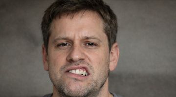 Красота не по зубам. Врач рассказал, почему из-за прикуса лицо может выглядеть старше