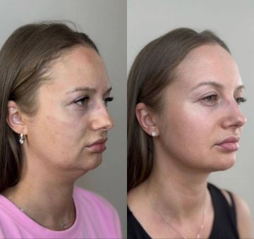 ��������� �������� ��������� ��������� ����� ����������� ����� ��� � ������ ����� ����, ����������� ����, ������� ������� � ������� ���������� � ������ ������� ����� ������� � �������