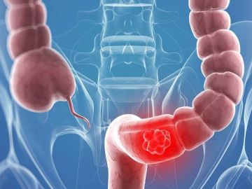 � 30-������ ������� �� ���� �������� ��� ��������� � ��������