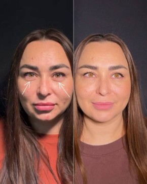 Приём ведёт команда специалистов с медицинским образованием в области косметологии приём будет проводиться 9 апреля