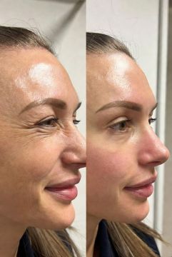 ���� ����������� �� ������