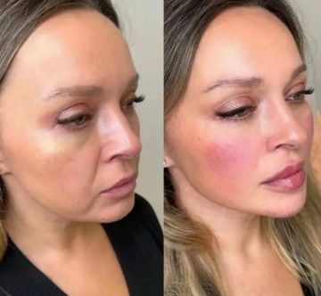 ���� ����������� � ����������