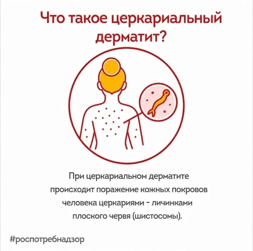 Безопасное купание: Роспотребнадзор информирует о мерах профилактики церкариального дерматита