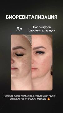9 ������� � ��� ����������!