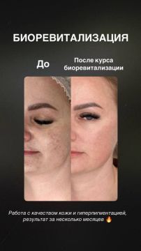 9 ������� � ��� ����������!